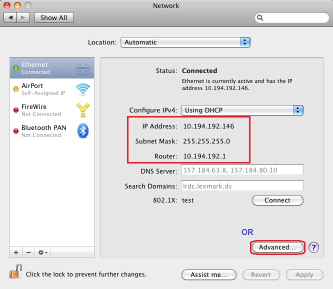 Checking IP parameters (IP Address, Netmask, Router Gateway) in